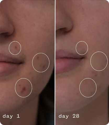 Anti-Aging Moisturizing Cream